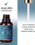 Azelaic Acid Facial Serum with Hinokitiol 30ml